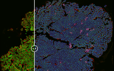 Annotation des cellules musculaires squelettiques